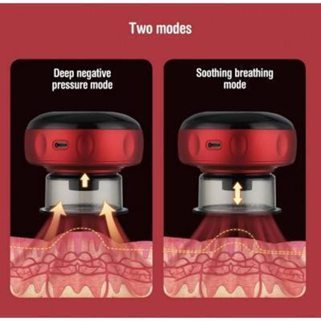 Βεντούζα κατά της Κυτταρίτιδας Inteligent Breathing Cupping Massage Instrument